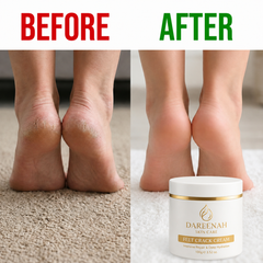 Dareenah Heel Luxe Cream